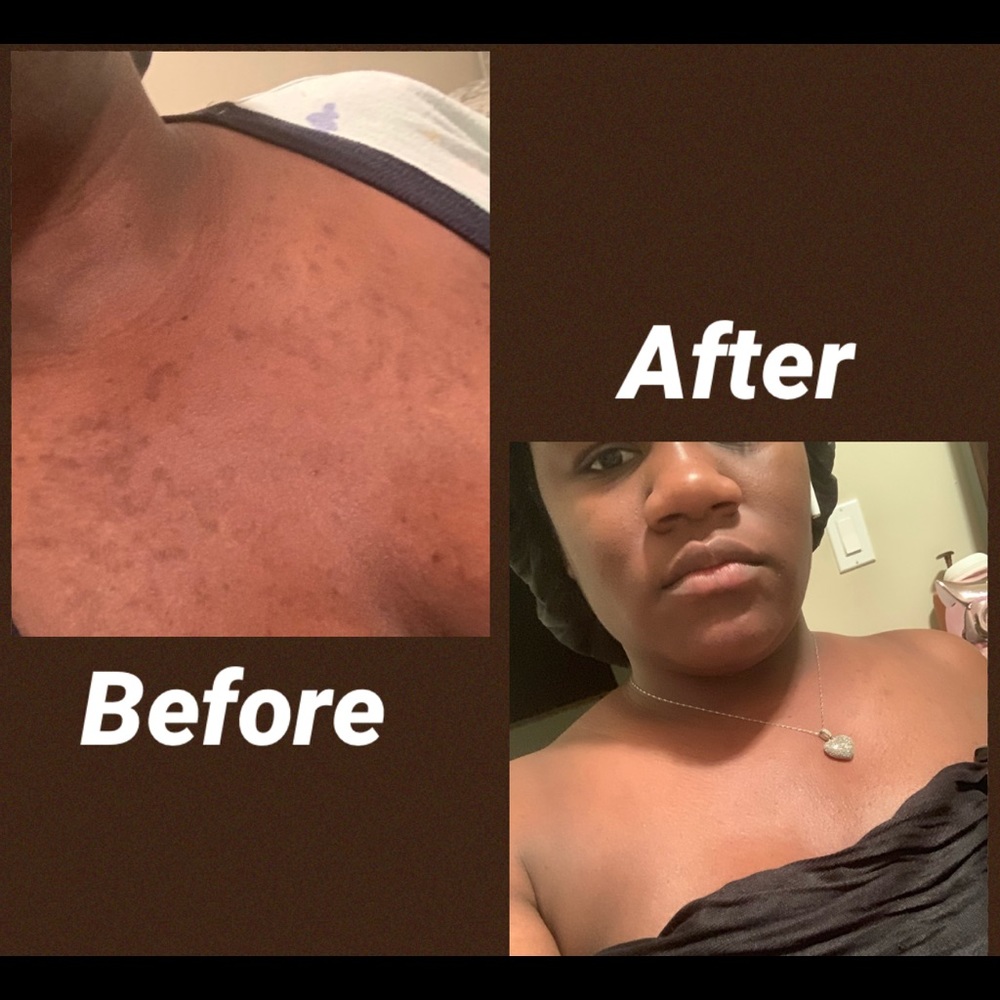 Cosmetic - Picture 5 of 8